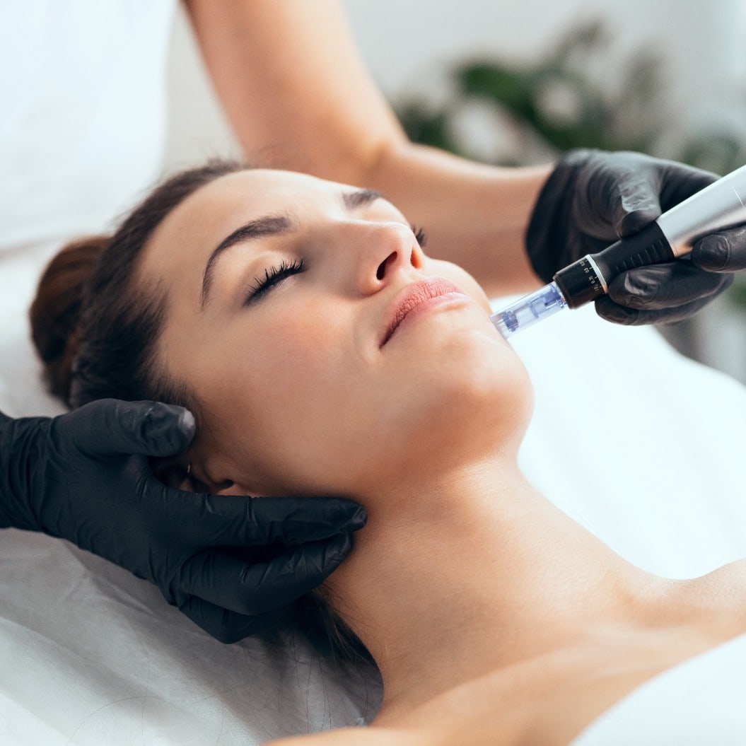 Kosmetikerin bei der Mesotherapie-Injektion mit dem Dermapen im Gesicht